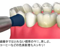 歯磨きではとれない煙草のヤニ、茶しぶ、コーヒーなどの色素新着もスッキリ!