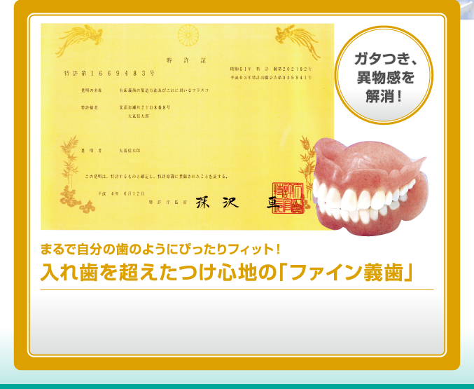 ガタつき、異物感を解消!まるで自分の歯のようにぴったりフィット!入れ歯を超えたつけ心地の「ファイン義歯」