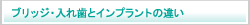 ブリッジ・入れ歯とインプラントの違い